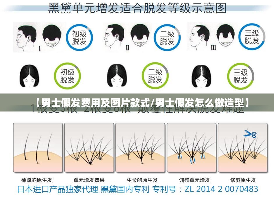 【男士假发费用及图片款式/男士假发怎么做造型】 【男士假发费用及图片款式/男士假发怎么做造型】