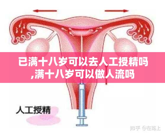 已满十八岁可以去人工授精吗,满十八岁可以做人流吗 已满十八岁可以去人工授精吗,满十八岁可以做人流吗